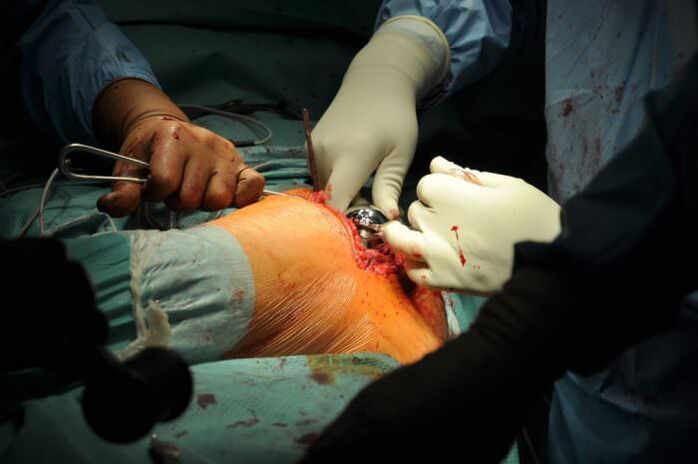 Traitement chirurgical