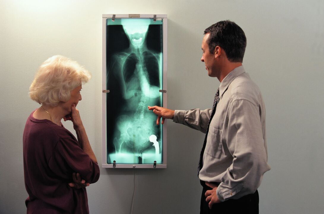 Diagnostic par rayons X pour la douleur dans l'articulation de la hanche